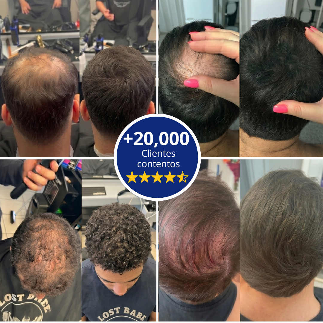 Follicle™ - Densificador capilar
