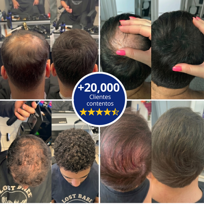 Follicle™ - Densificador capilar
